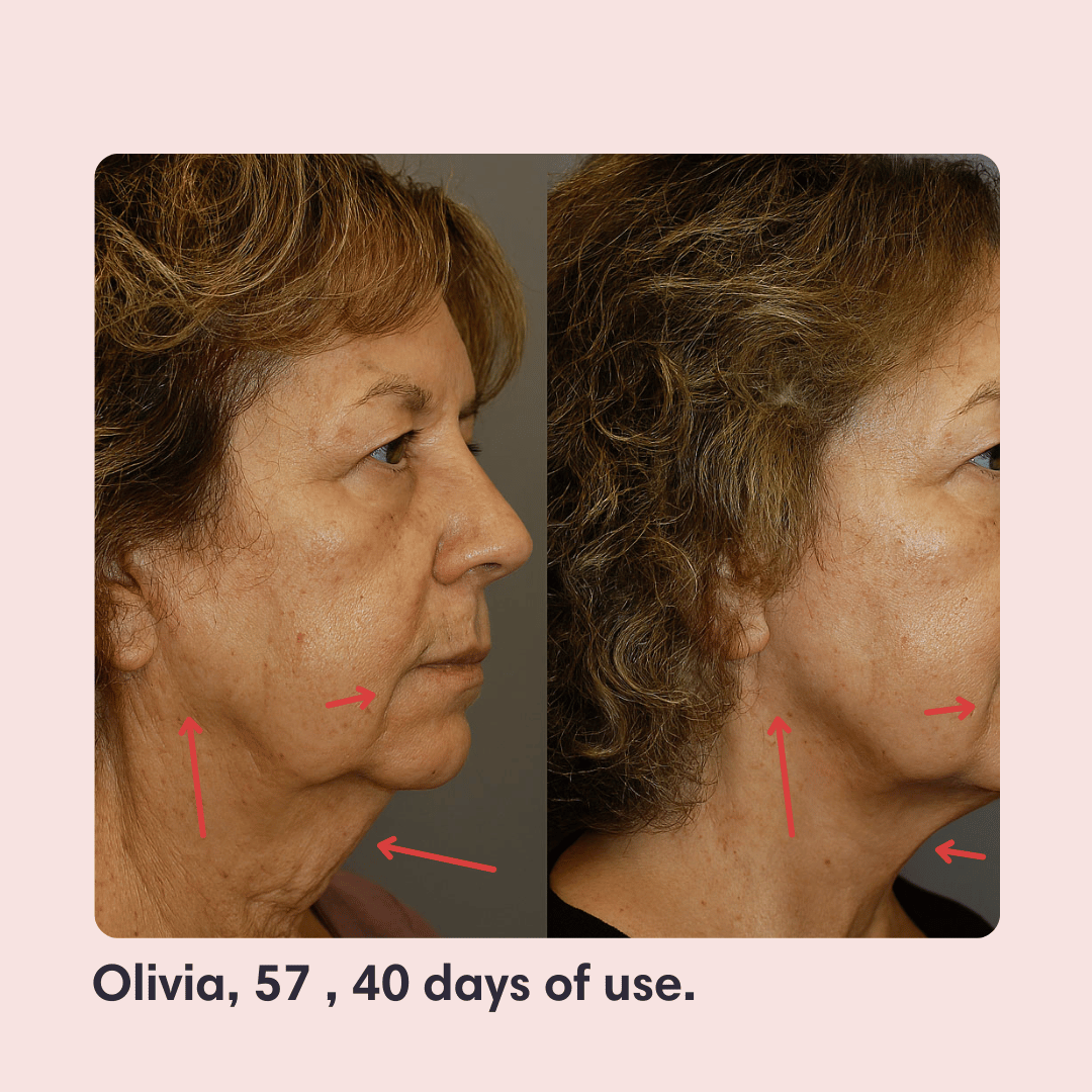 Elevé Ultra-Firm Lifting Strap