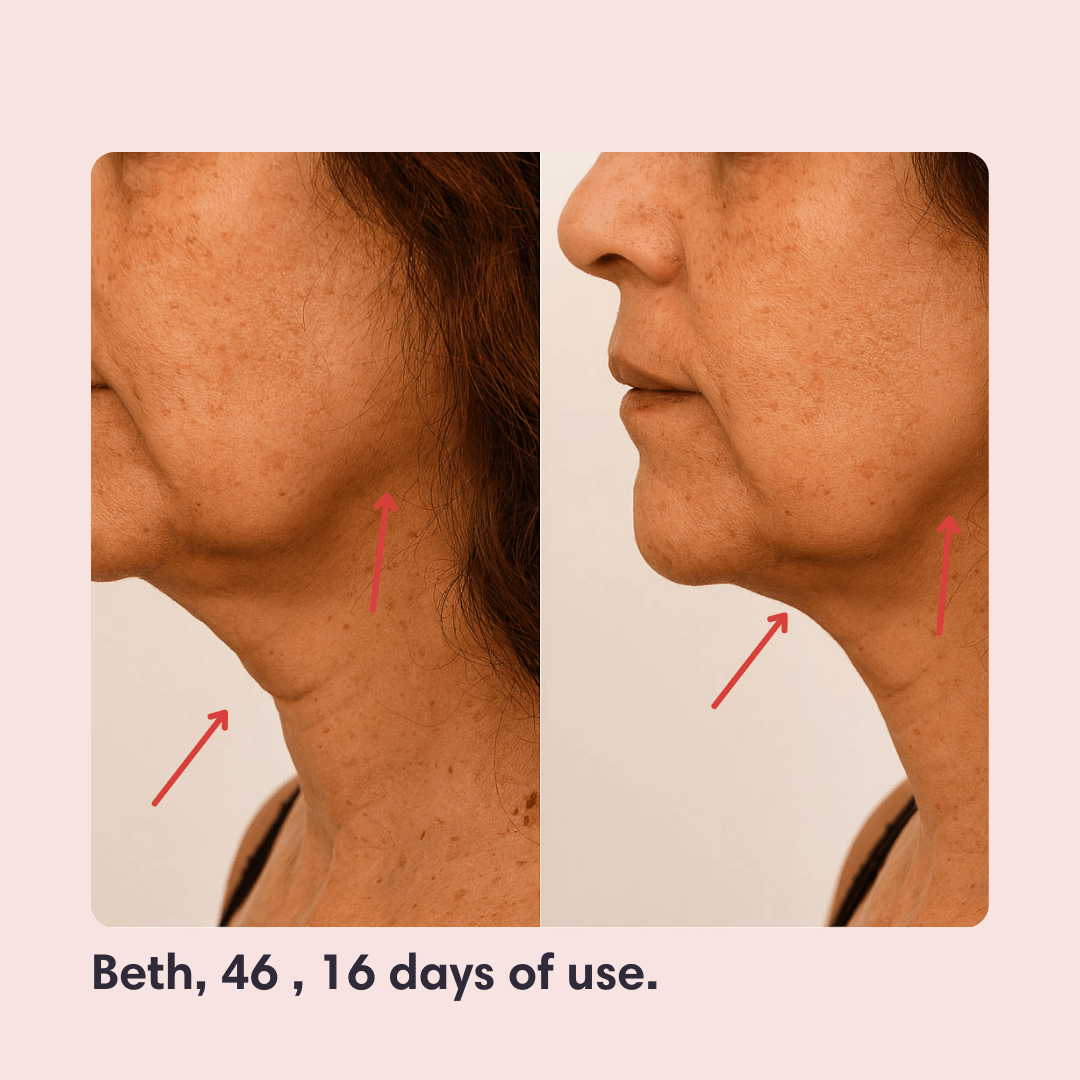 Elevé Ultra-Firm Lifting Strap