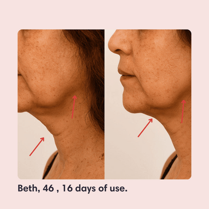 Elevé Ultra-Firm Lifting Strap