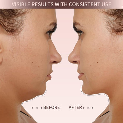 Elevé Face Shaper