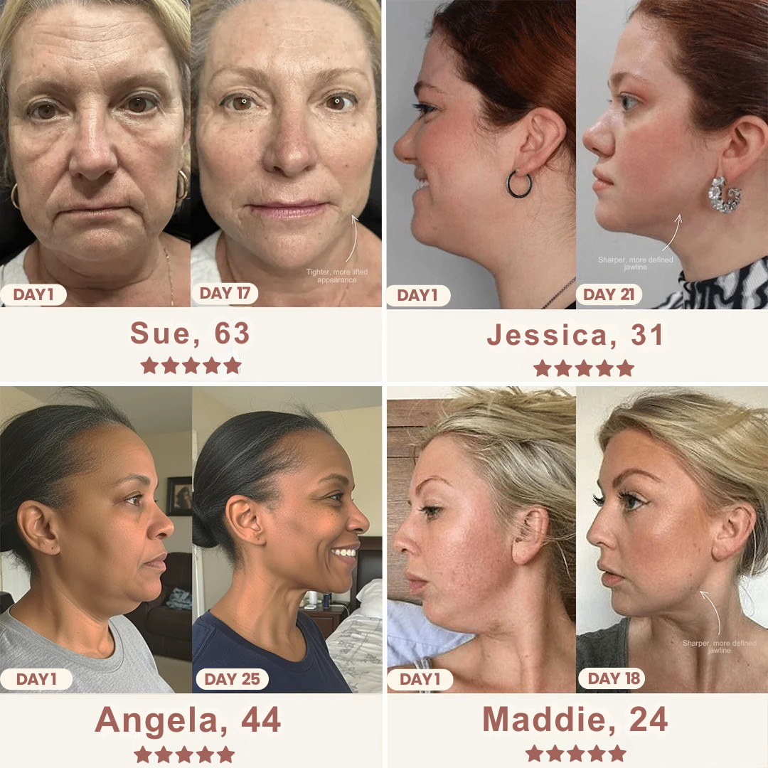 The Elevé Face Shaper